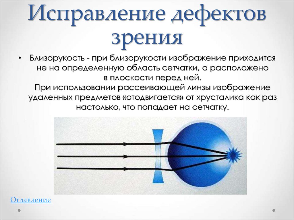 Какие дефекты зрения изображены на рисунках предложите дорисуйте способы их исправления