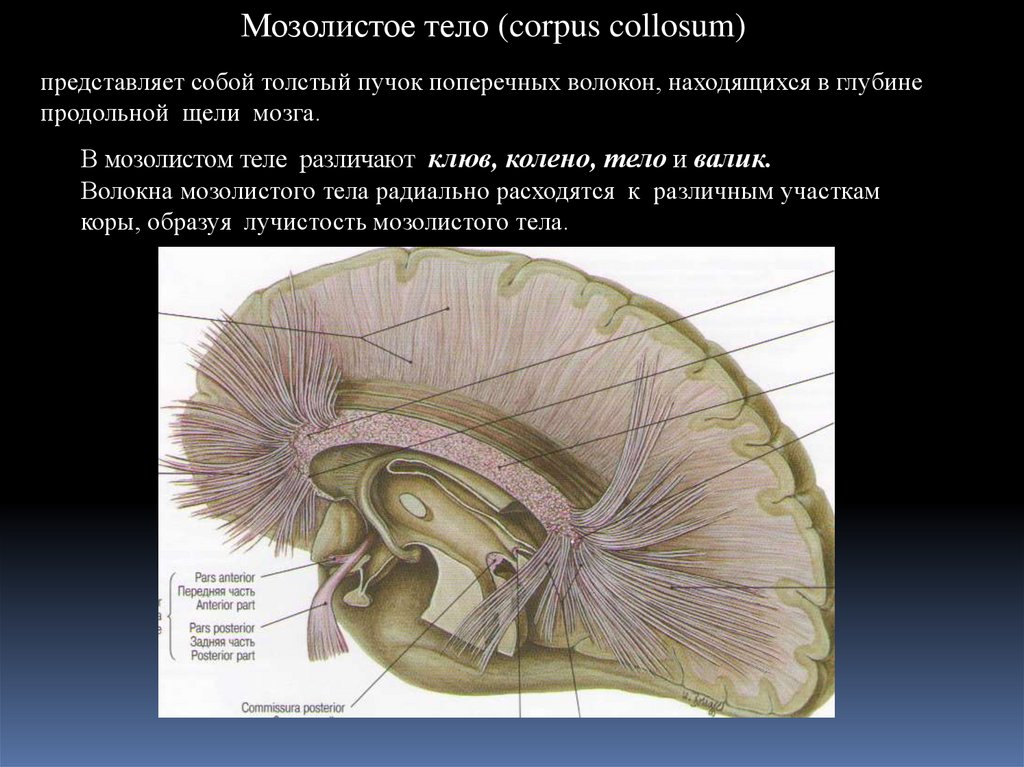 Клюв мозолистого тела