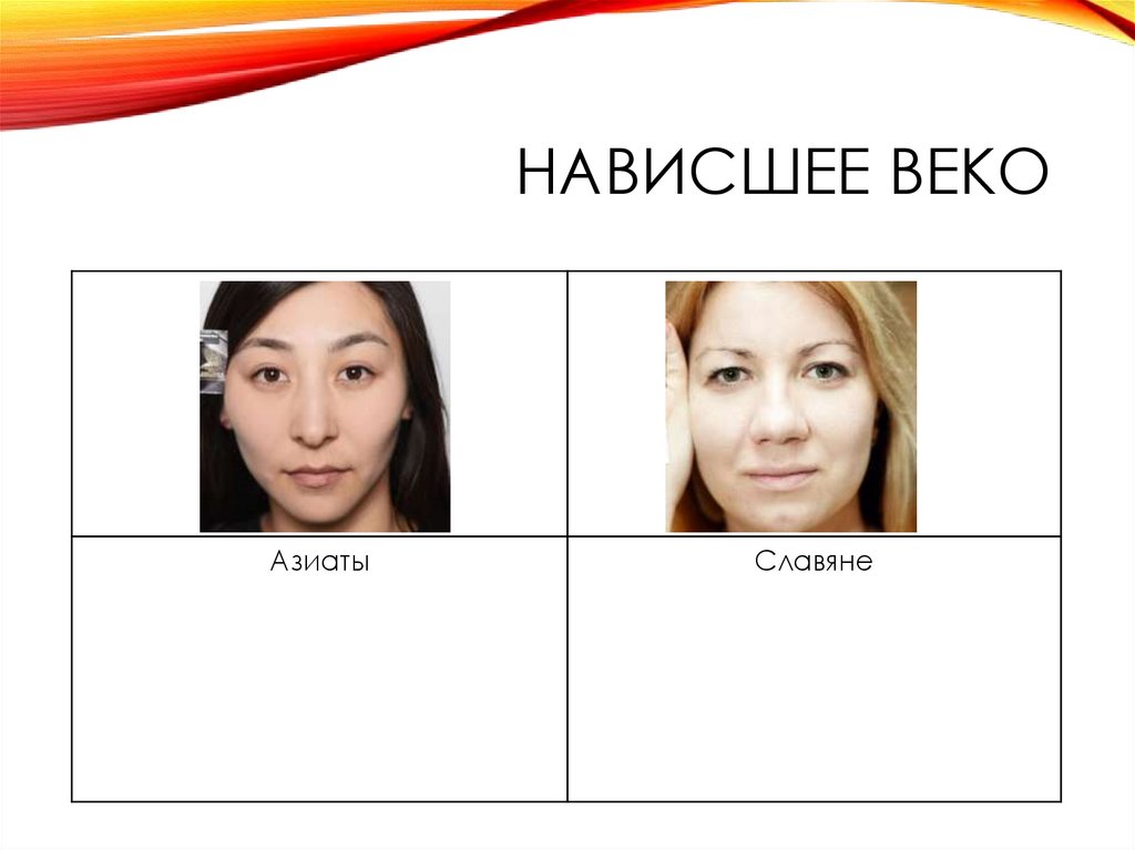 Нависшее веко