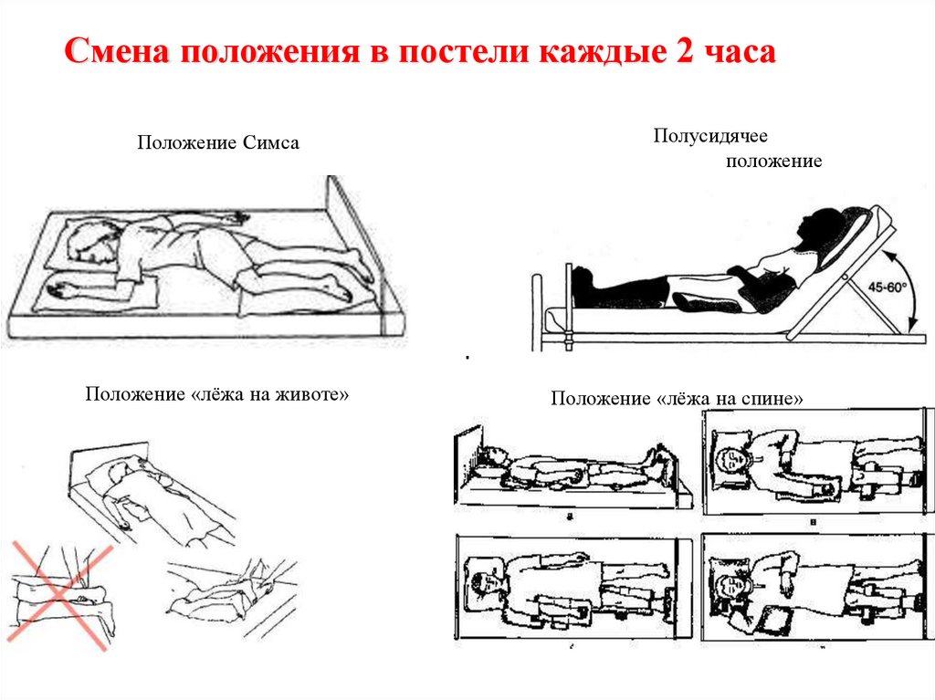 Различные положения пациента в постели схема