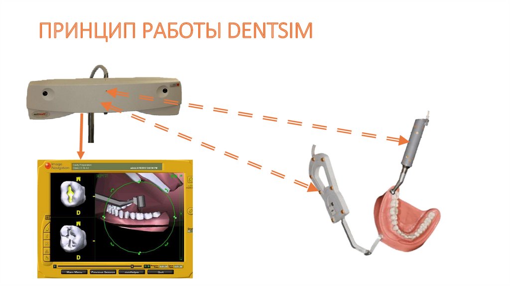 ПРИНЦИП РАБОТЫ DENTSIM