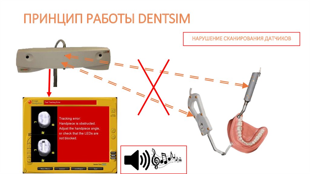 ПРИНЦИП РАБОТЫ DENTSIM