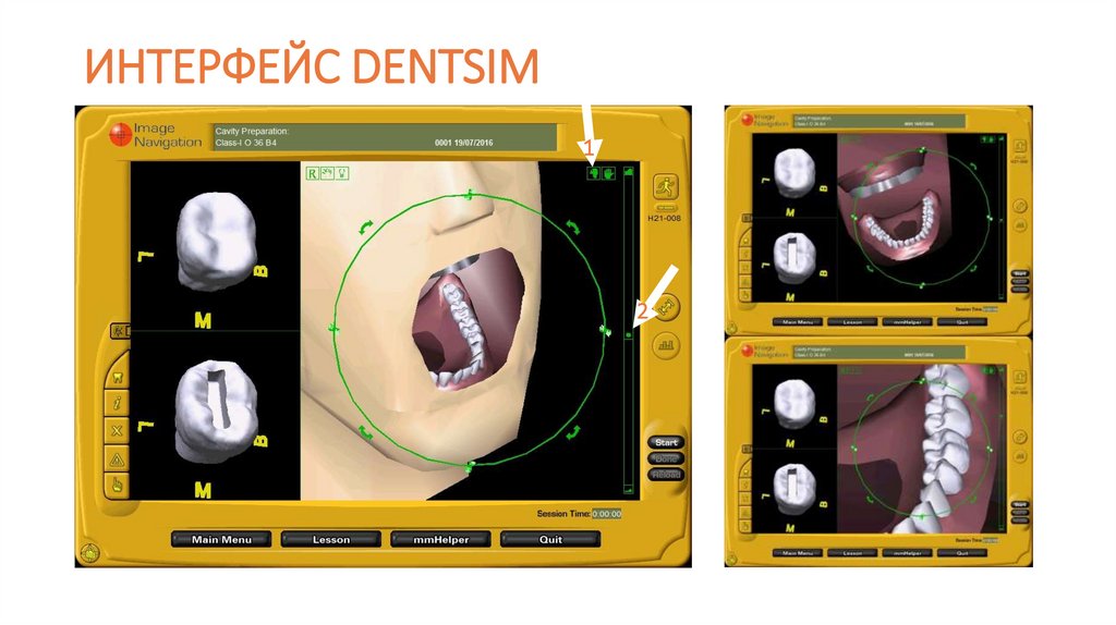 ИНТЕРФЕЙС DENTSIM