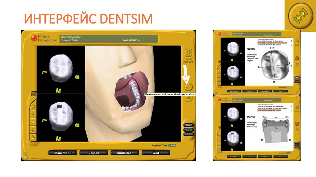 ИНТЕРФЕЙС DENTSIM