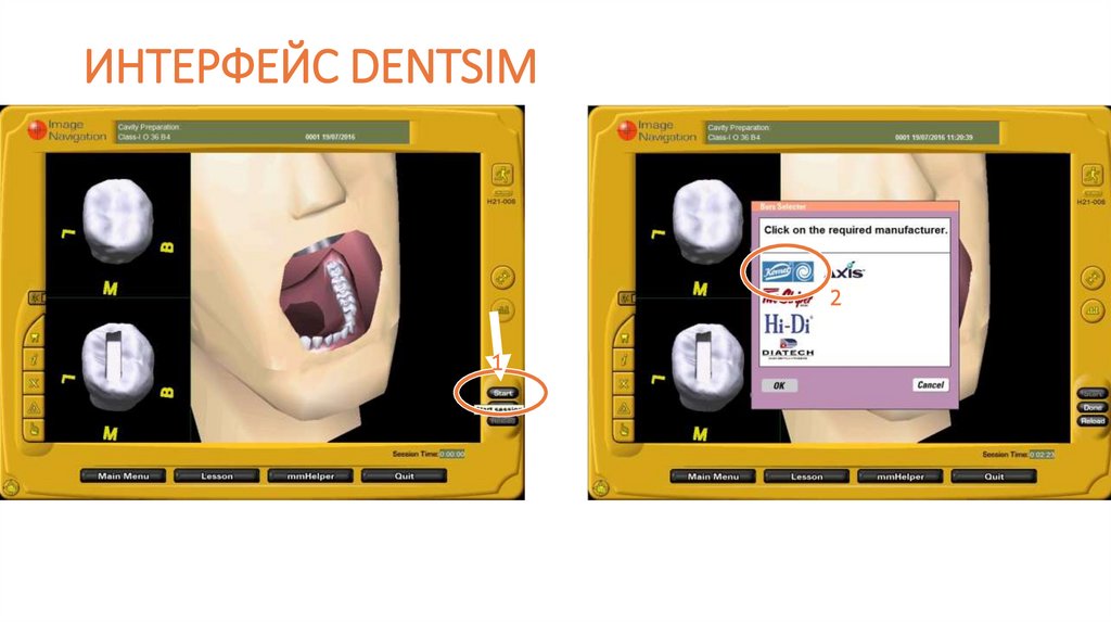 ИНТЕРФЕЙС DENTSIM