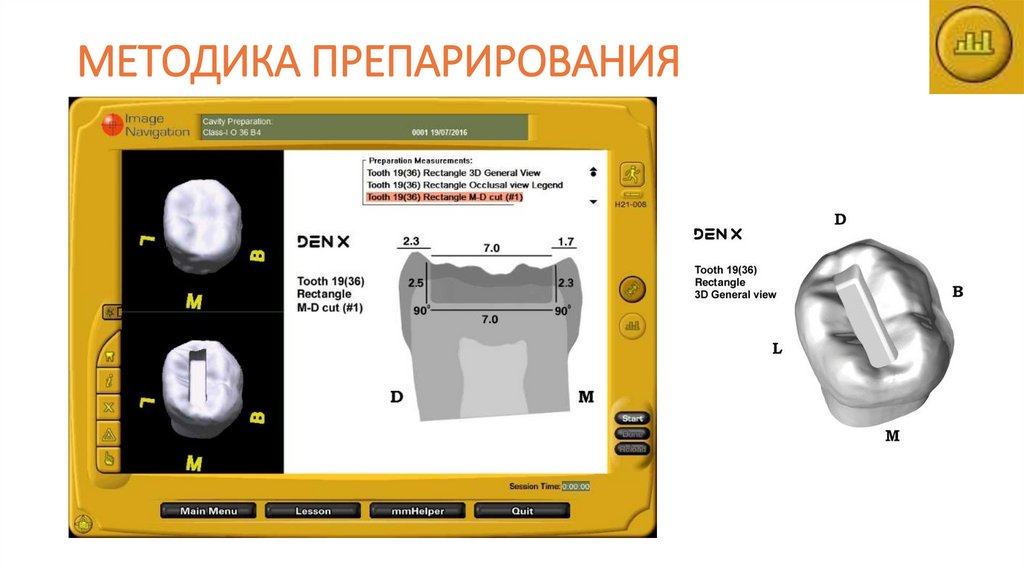 МЕТОДИКА ПРЕПАРИРОВАНИЯ