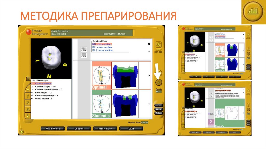 МЕТОДИКА ПРЕПАРИРОВАНИЯ