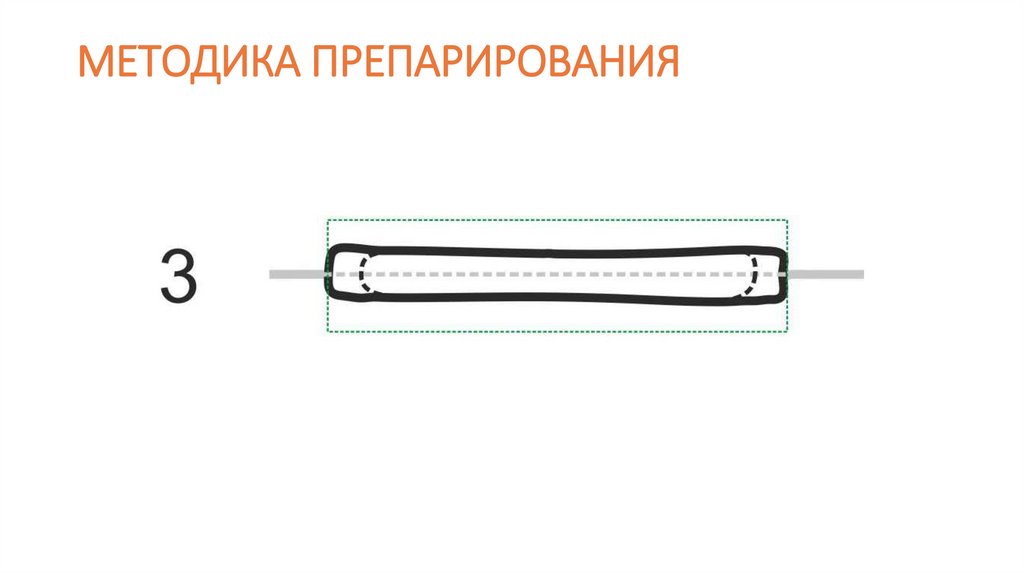 МЕТОДИКА ПРЕПАРИРОВАНИЯ