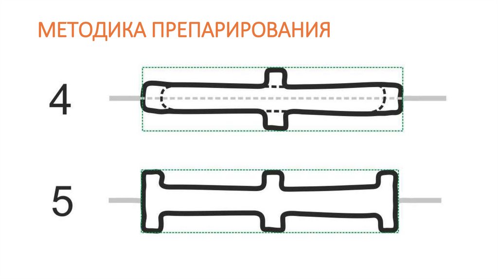 МЕТОДИКА ПРЕПАРИРОВАНИЯ