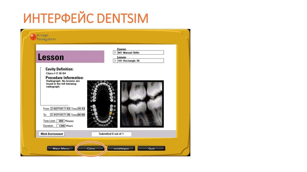 ИНТЕРФЕЙС DENTSIM