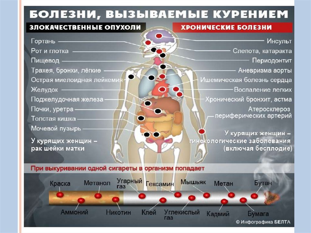 Болезни от курения презентация