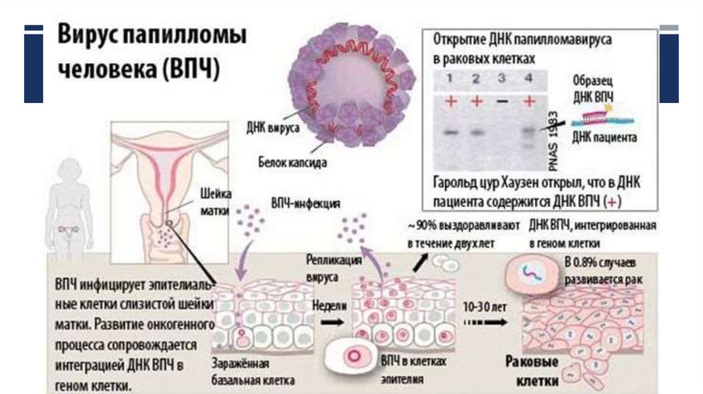 Анализ на раковые клетки шейки матки. Патогенез папилломавирусной инфекции. ВПЧ высокого онкогенного типа. Пути инфицирования передачи папилломавируса. Вируспопиломы человека.