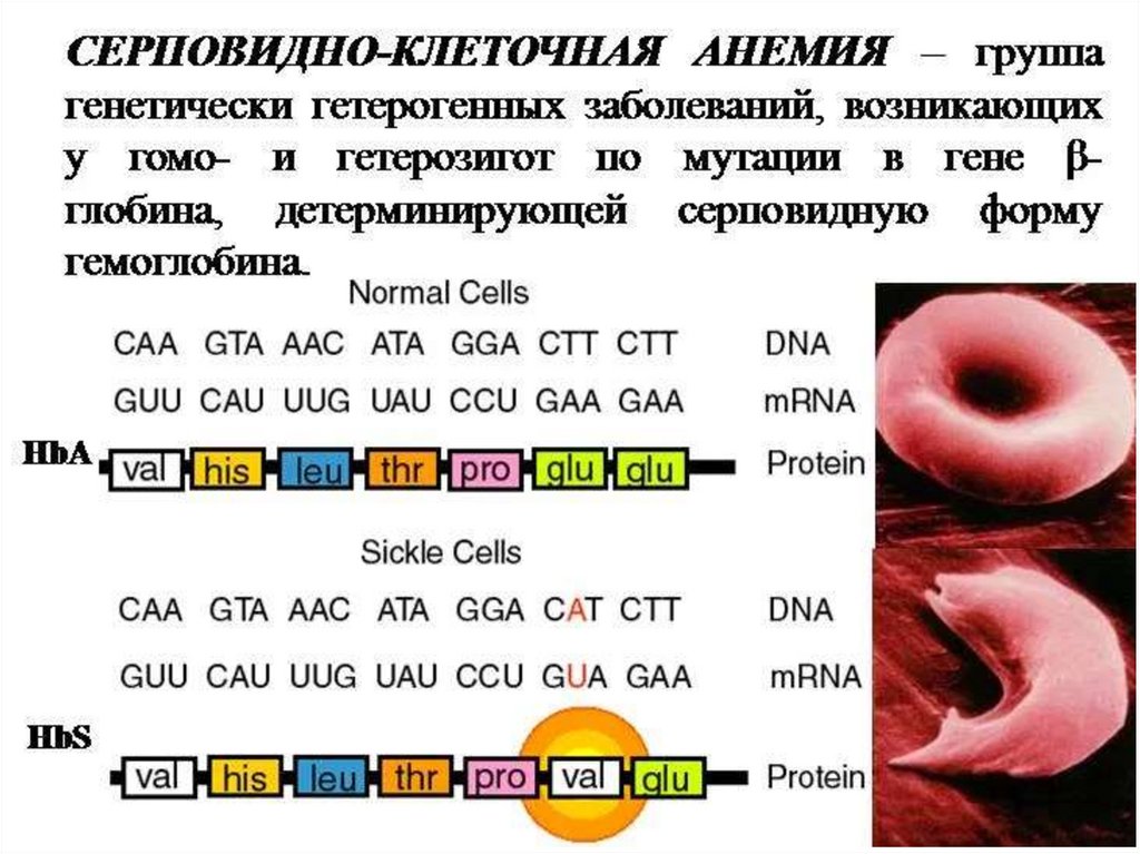 Серповидноклеточная анемия какая