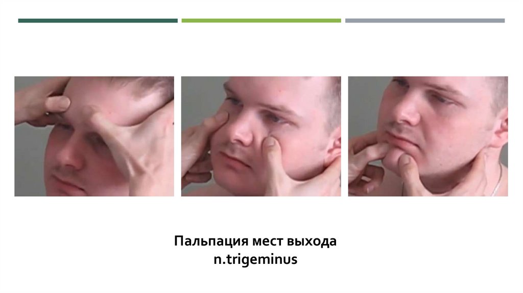Менингеальные симптомы - презентация онлайн