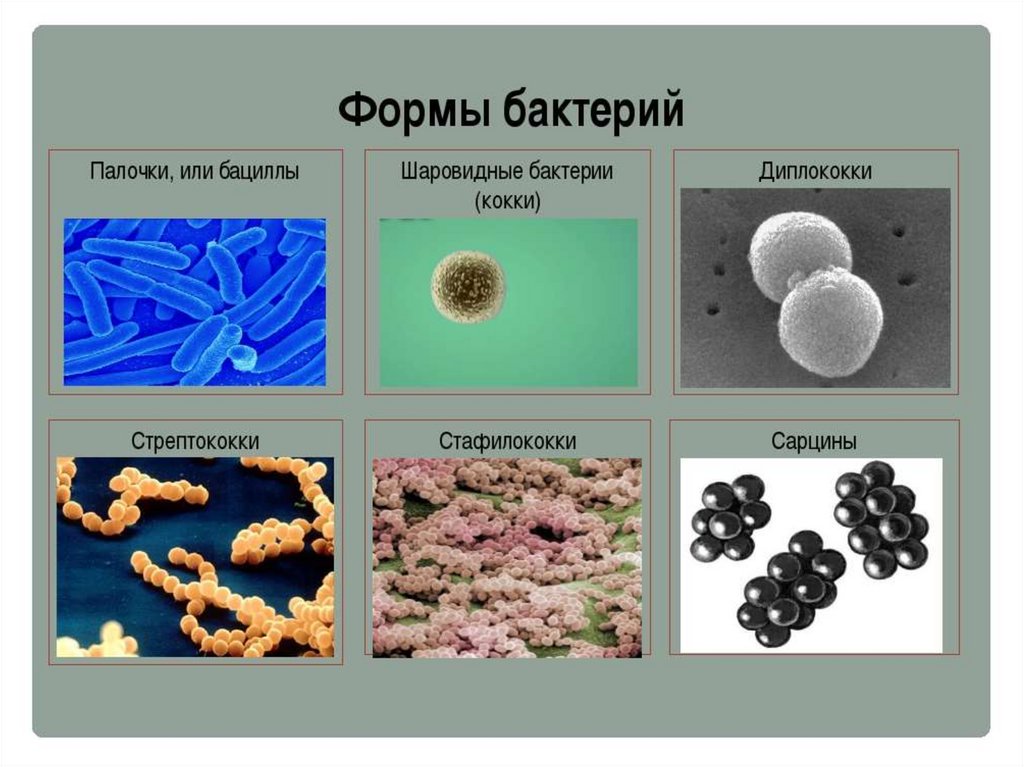 Сделайте вывод о разнообразии форм тела бактерий. Доклад по биологии 5 класс на тему микробы. Формы бактерий 5 класс биология бацил. Бактерии презентация. Презентация на тему бактерии.