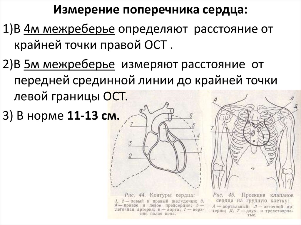 Верхушка сердца. Определение поперечника сердца. Верхушка сердца расположена. Схема аускультации сердца.