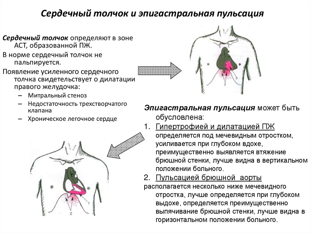 Сердечный толчок