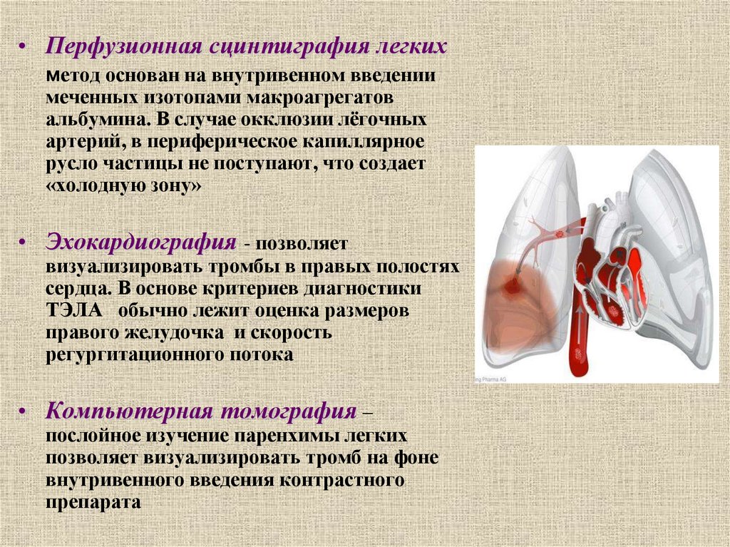 Артериальная тромбоэмболия. Профилактика тромбоэмболии легочной артерии. Тромбоэмболия легочных артерий справка. Отток легочной артерий 180-190 у новорожденного. Тромбоэмболия без падения сатурации.