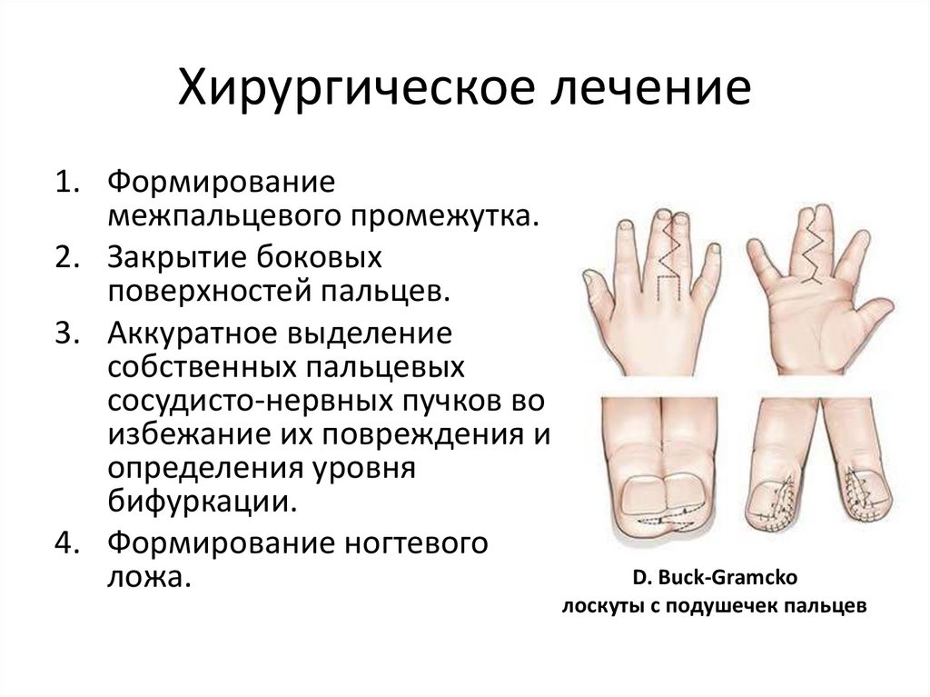 Хирургическое лечение