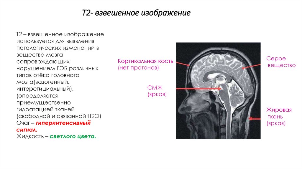 Мрт 2024 года