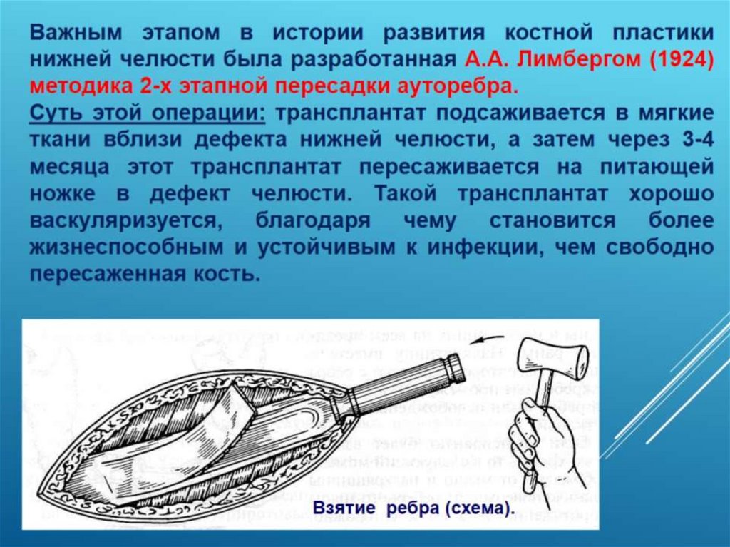 Костная пластика презентация