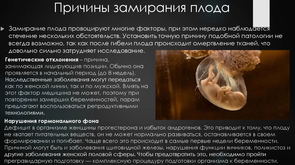 Внутриутробное замирание плода - презентация онлайн