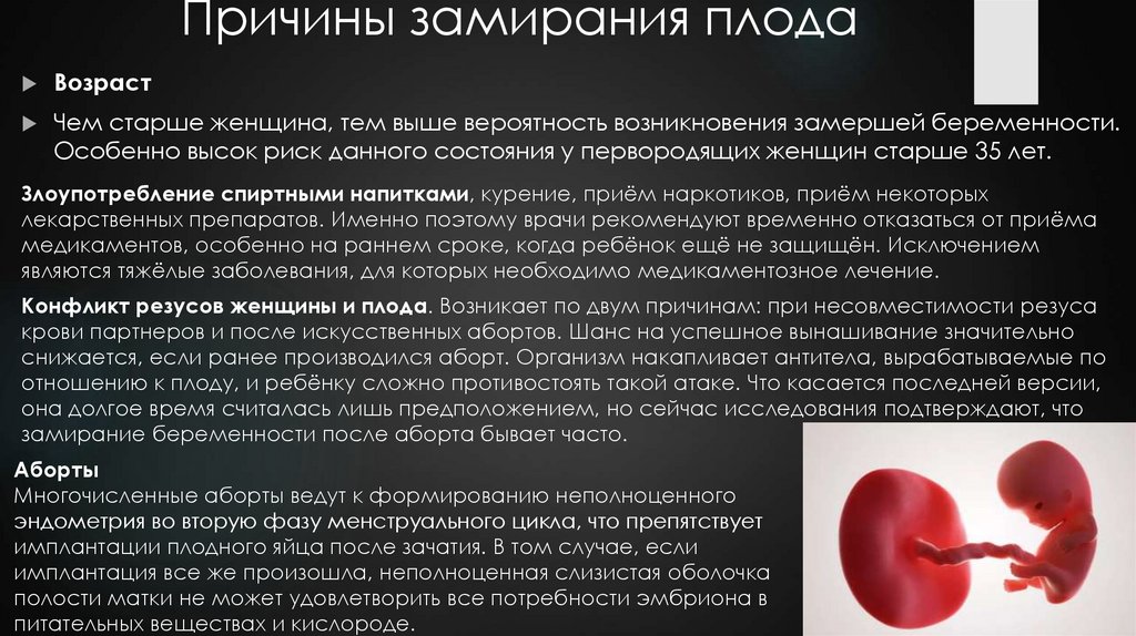 Причины замирания плода
