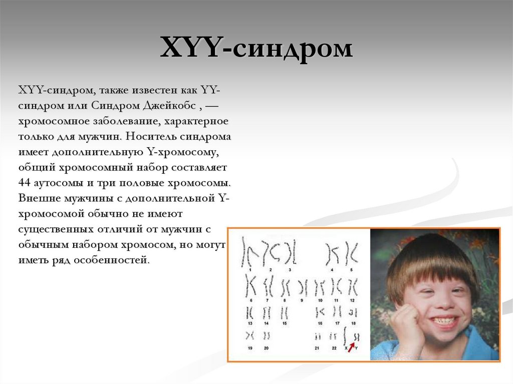 Появление дополнительной хромосомы. XYY синдром. Полисомия по у-хромосоме. XYY хромосомы синдром.