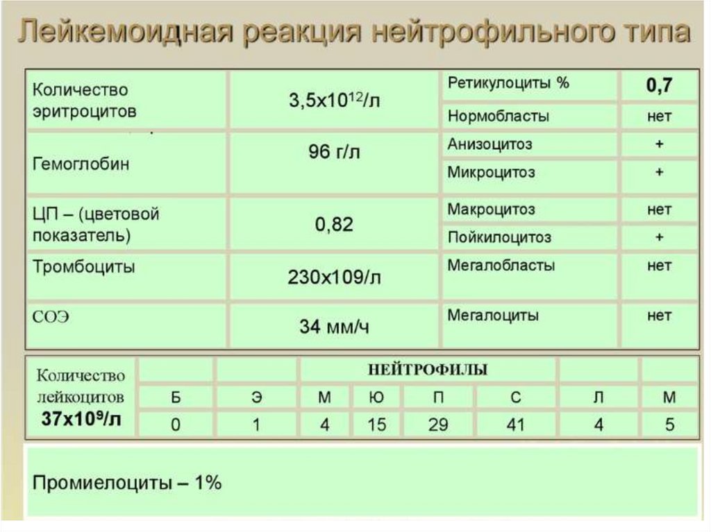 Лейкозы лейкемоидные реакции. Нейтрофильная лейкемоидная реакция. Лейкемоидная реакция нейтрофильного типа. Лейкемоидная реакция анализ. Лейкемоидная реакция анализ крови.