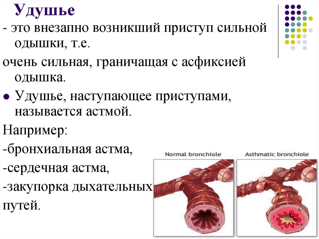 Удушье это. Сердечная и бронхиальная астма. Что такое одышка, удушье, астма.. Приступ удушья.