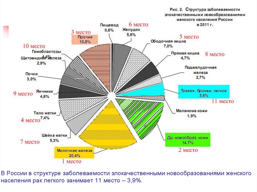 Заболеваемость злокачественными опухолями