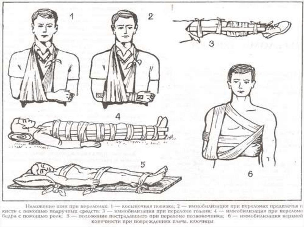 Перелом пальца кисти карта вызова скорой медицинской - 94 фото