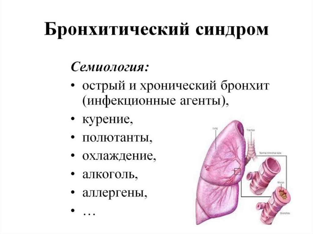 Бронхитический синдром