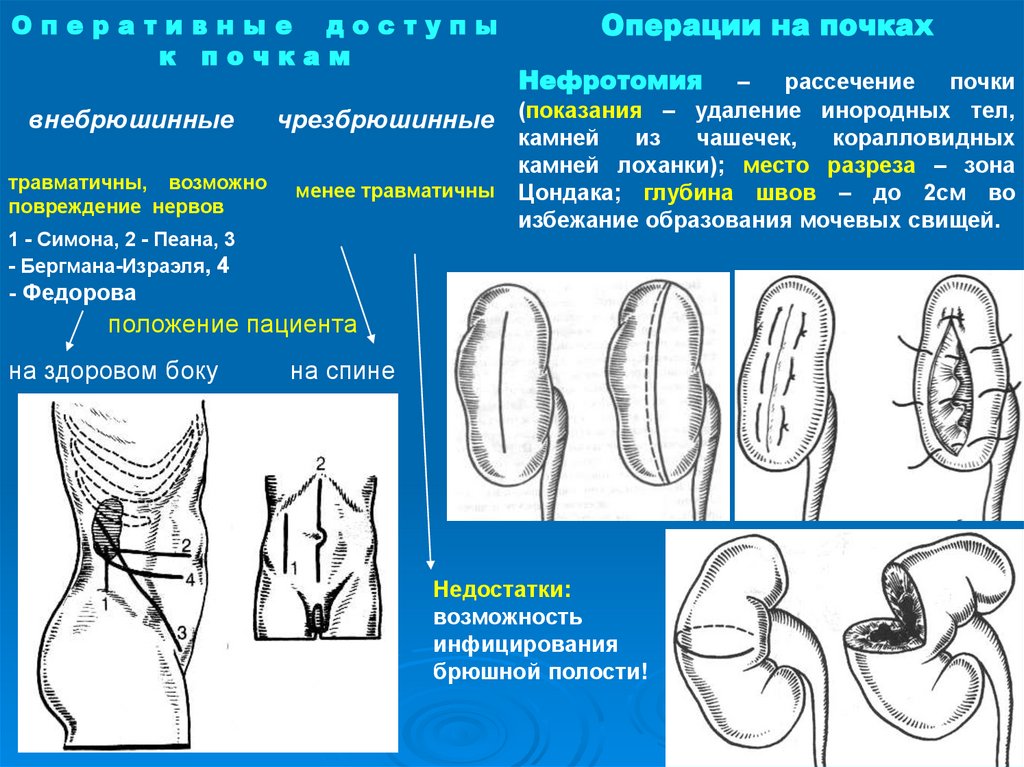 Операция герлока схема