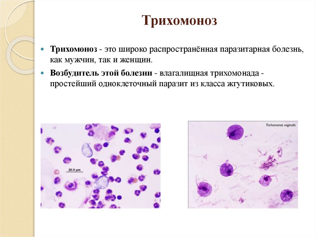 Trichomonas vaginalis пцр