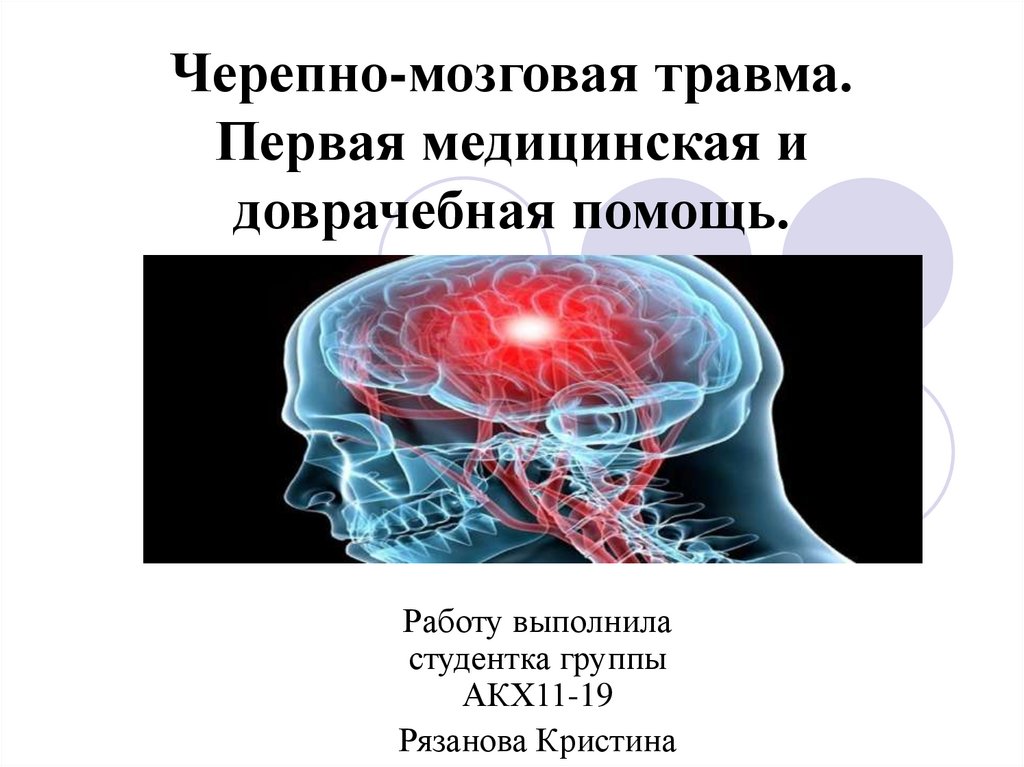 Зчмт смп. Черепно-мозговая травма презентация. Черепно-мозговая травма доврачебная помощь. Закрытая черепно-мозговая травма.