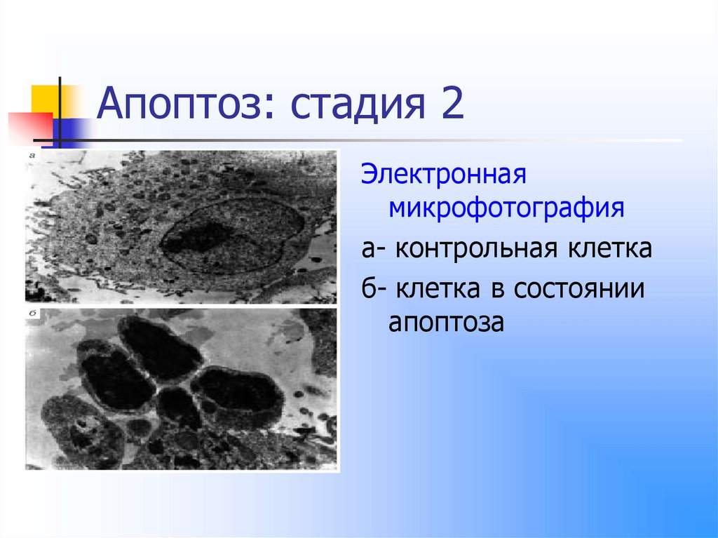 Апоптоз патанатомия презентация