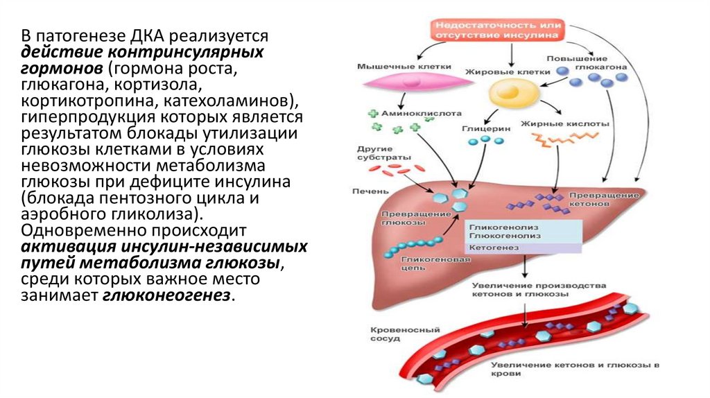 Патогенез кетоацидоза - online presentation