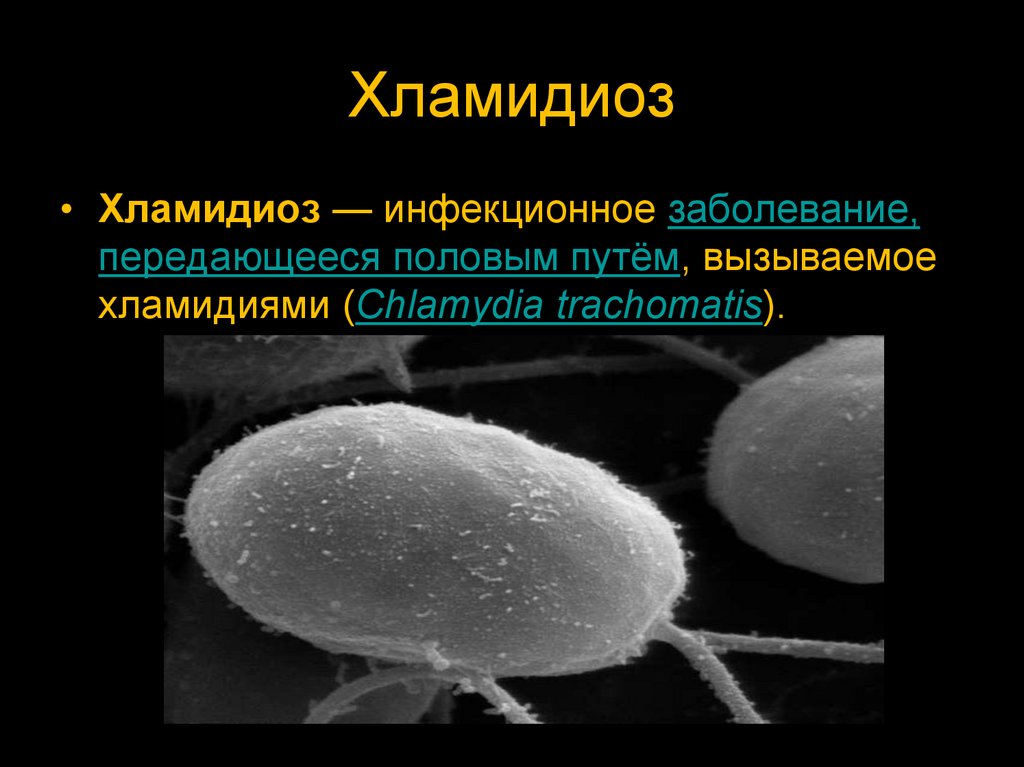 Половые заболевания презентация