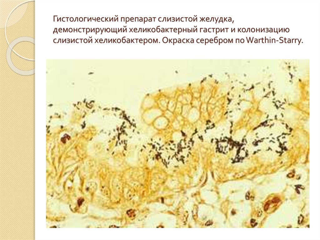 Слизистые препараты. Возбудитель Legionella pneumophila. Легионеллы микробиология морфология. Legionella pneumophila окраска по Граму. Легионеллез микробиология морфология.