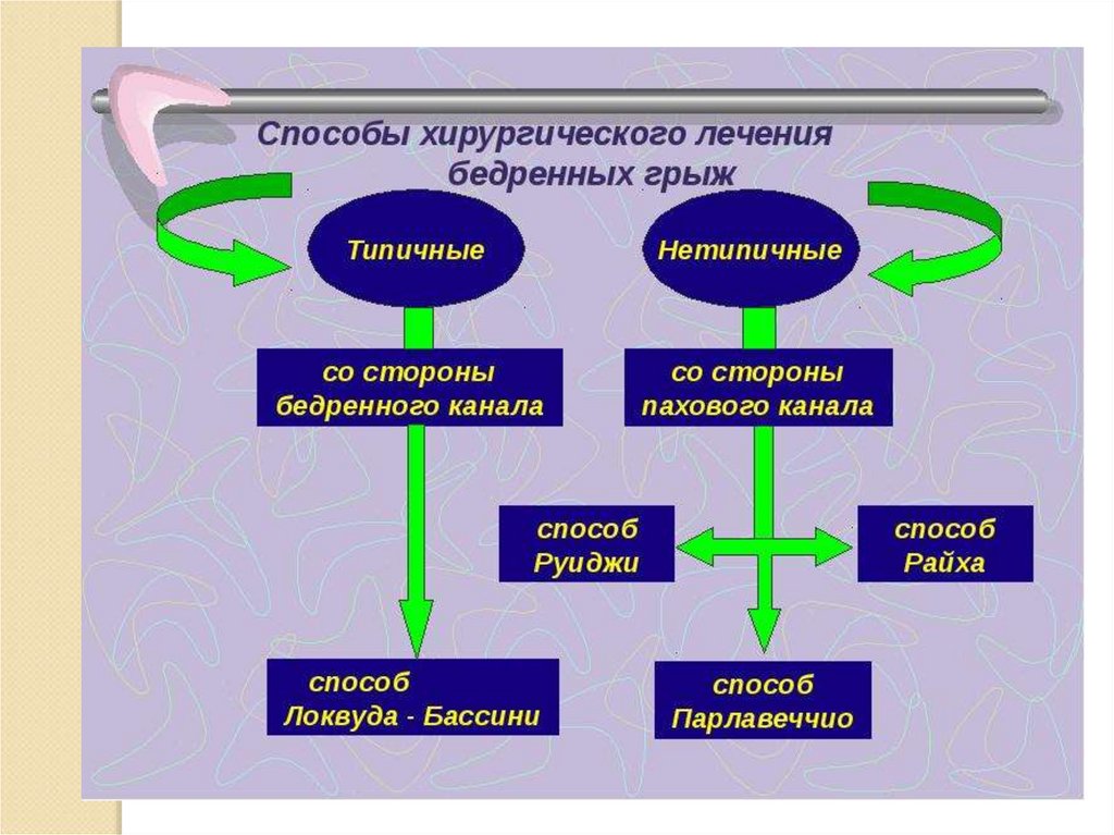 Паховая грыжа методы лечения