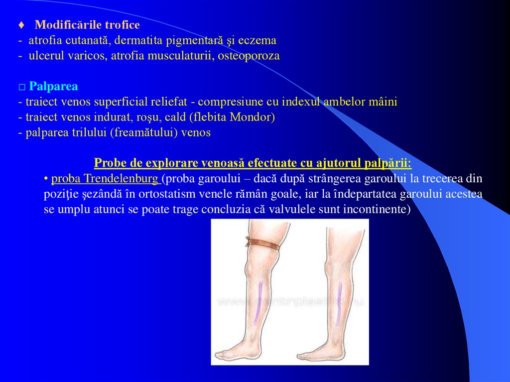 medicament împotriva inflamației genunchiului tratamentul tendoanelor de umăr
