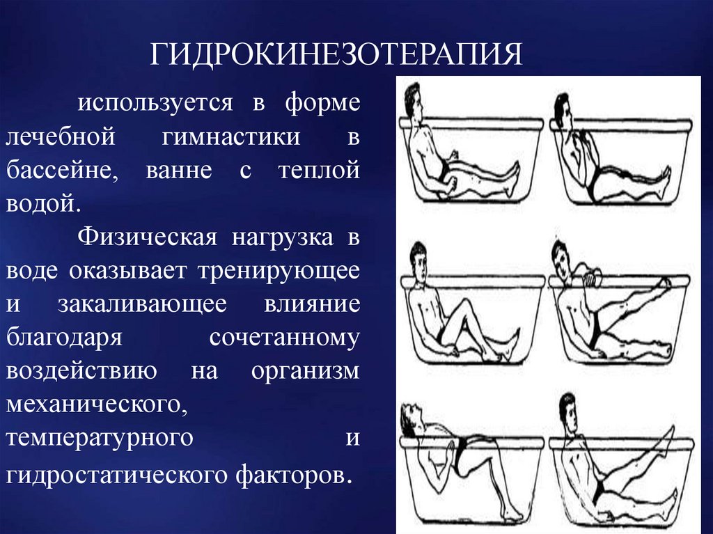 Гимнастика при ишемии мозга