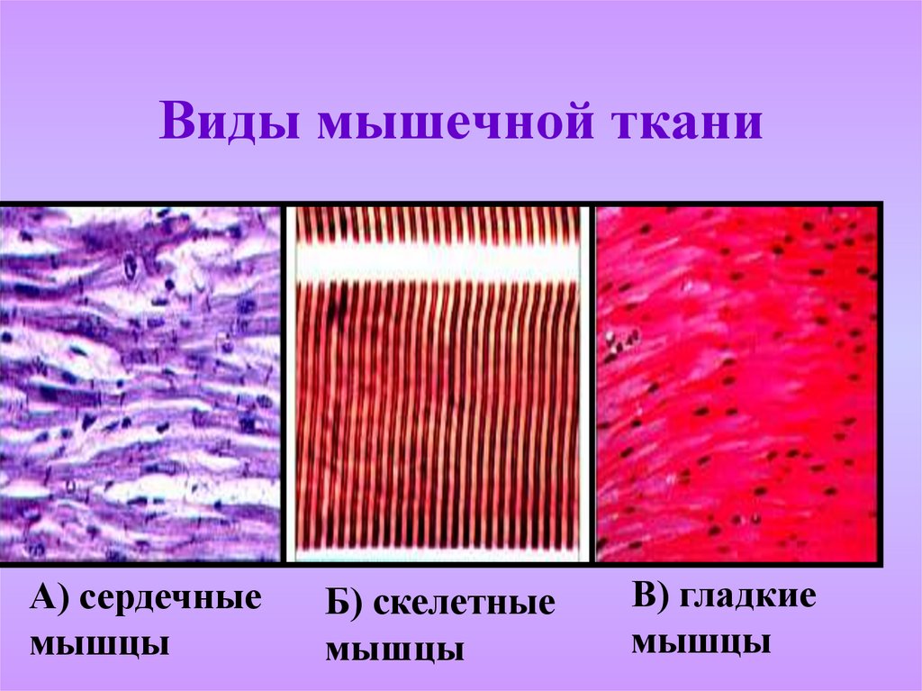 В скелетной мышечной ткани клетки какие. Поперечнополосатая Скелетная мышечная ткань гистология. Исчерченная поперечнополосатая Скелетная мышечная ткань. Скелетная сердечная и гладкая мышечная ткань. Поперечнополосатая Скелетная мышечная ткань препарат.