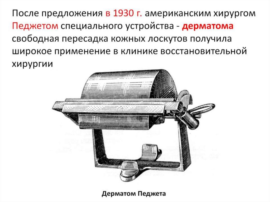 Пластика с применением свободной пересадки тканей презентация