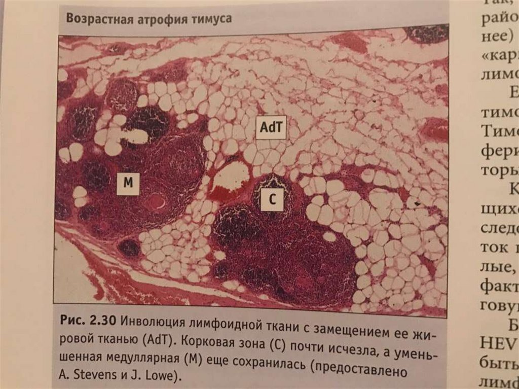 Препарат тимус гистология рисунок с подписями