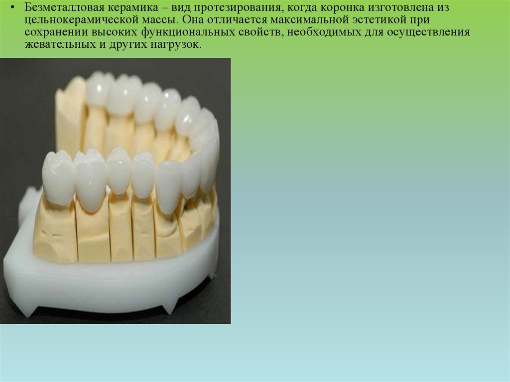 Презентация безметалловая керамика