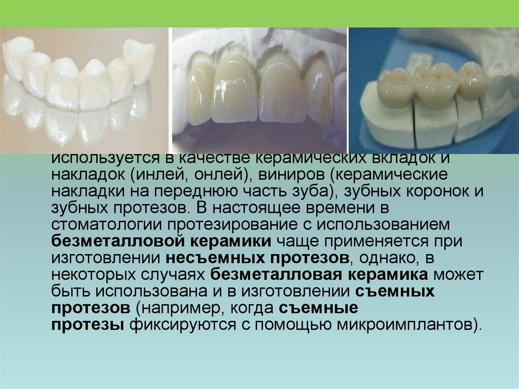 Презентация безметалловая керамика