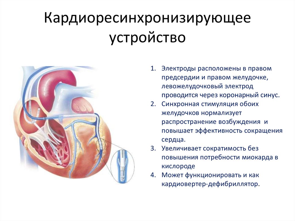 Хсн презентация терапия