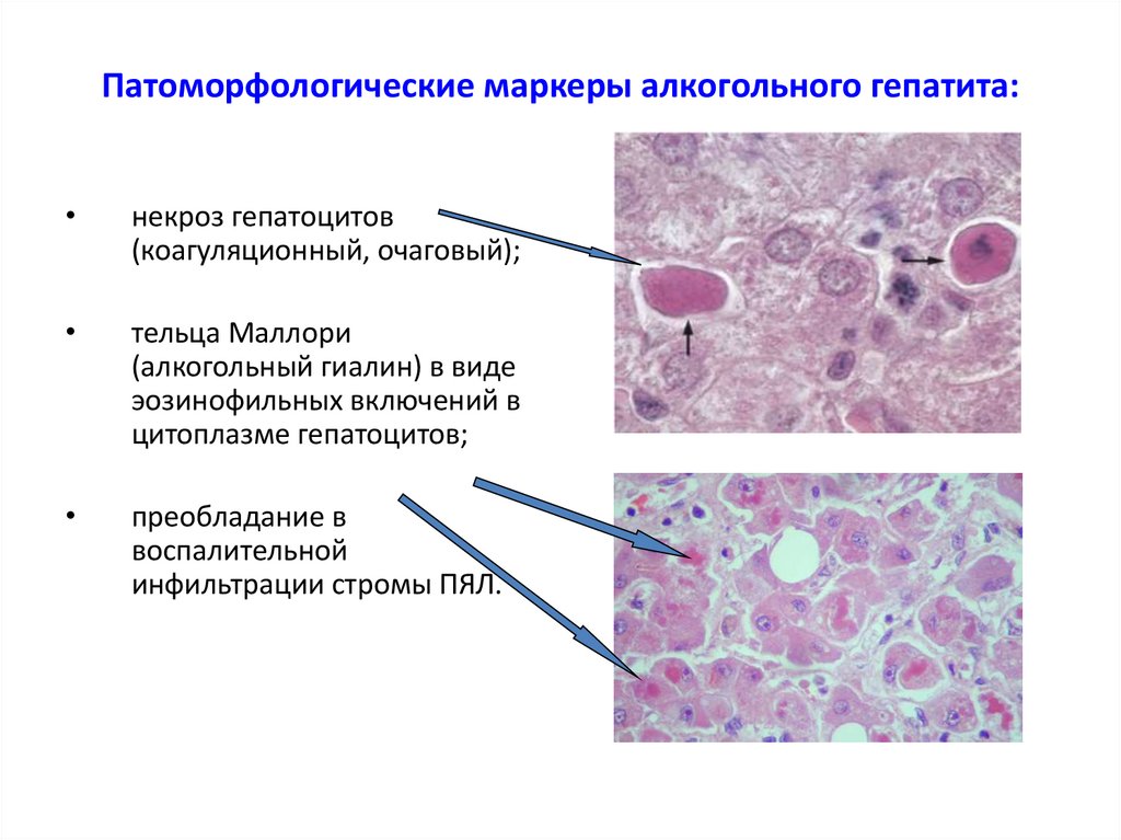 Патоморфологическая картина это